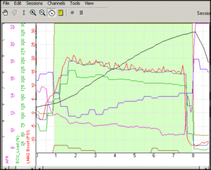 JDMMAP vs ZT-2 MAP-boost_spikes.gif