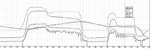 96530706 + DMA +LiveMap + SD - working-logic-sd.jpg