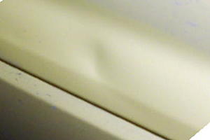 Dent help!!-dent-1.jpg
